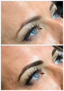 Brows before and after