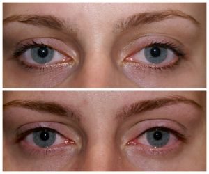 Eyeliner Cosmetic Tattoo Sydney