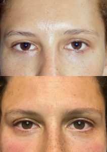 eyebrows before and after cosmetic tattoo