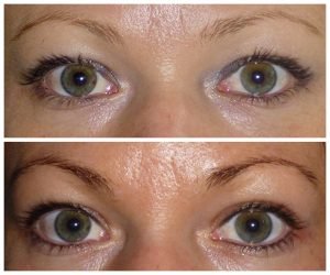 Invisible Eyeliner permanent makeup Sydney