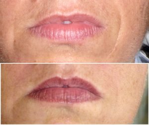 before and after permanent makeup