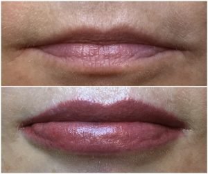 Lips Tattoo before and after Sydney